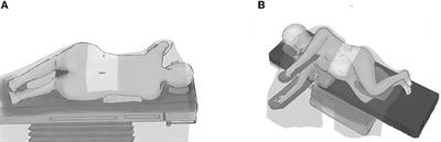 Lumboperitoneal shunt surgery via continuous two-stage procedure: Technique notes and outcomes